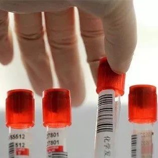 关于艾滋病的这几大误区