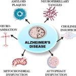 “隐秘的杀手”阿尔兹海默症：发病机制及全球药物研发现状盘点