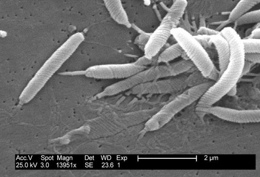 来源:电子显微镜下的幽门螺杆菌(wikipedia)非侵入性幽门螺杆菌检测非