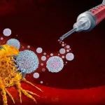 速递 | “现货型”干细胞疗法获FDA优先审评资格，治疗血液癌症