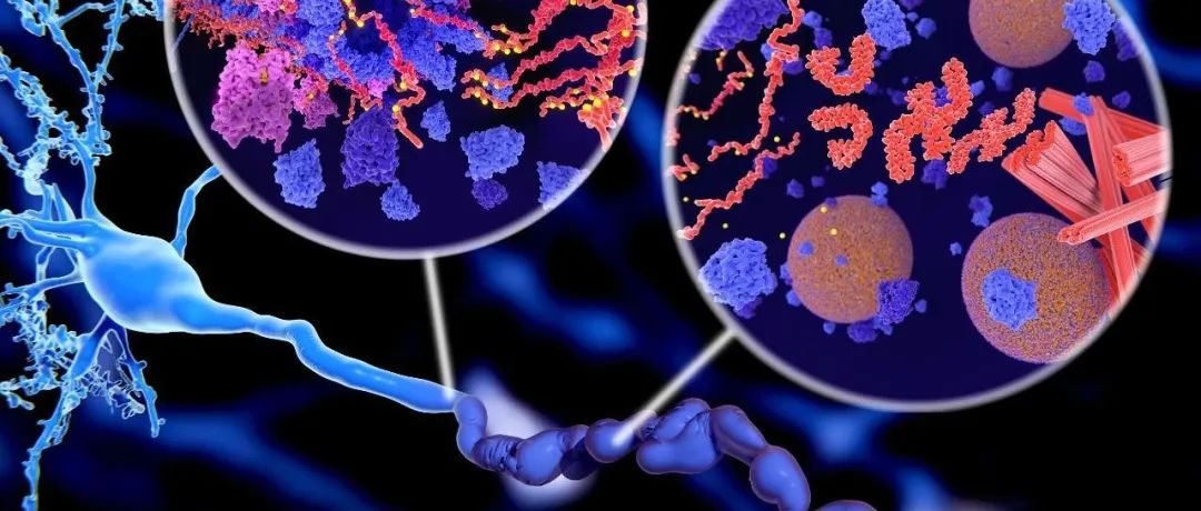 阿尔兹海默症治疗新方法！Nature重磅：靶向T细胞和小胶质细胞间的毒性交联预防神经退行性变