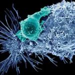 Science子刊：新机制提高CAR-T抗肿瘤持久性，有助于预防肿瘤复发丨医麦猛爆料