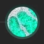 Target Laboratories完成2100万美元融资，开发癌症荧光标记物