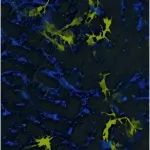 Science子刊：新研究为开发副作用更少的癌症免疫疗法铺平道路