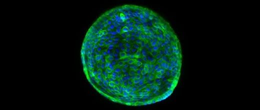重大突破：人造类器官“迷你胆管”首次成功修复人类肝脏