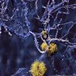 研发卟啉症治疗药物，罗氏与Disc Medicine达成2亿美元全球独家许可协议