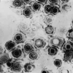 识别出有望攻击疱疹病毒感染的新方法