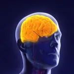 阿尔茨海默氏症药物，从Bapineuzumab到Donanemab，抗Aβ抗体的研发因何迷雾重重？