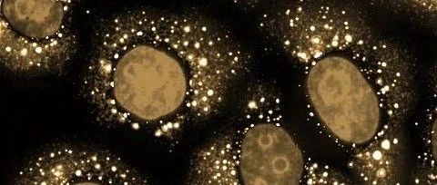 默沙东、辉瑞、拜耳等巨头争相布局！生物分子凝聚体，或成药物研发下一个风口