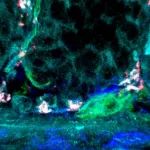 Nature | 苏冰团队发现新型肠道间质细胞并揭示其在炎症过程中调控肠道干细胞Niche的损伤修复机制
