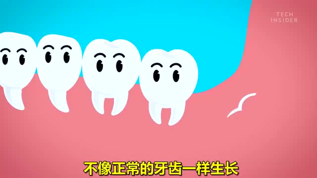 科普短片《关于智齿的小秘密》