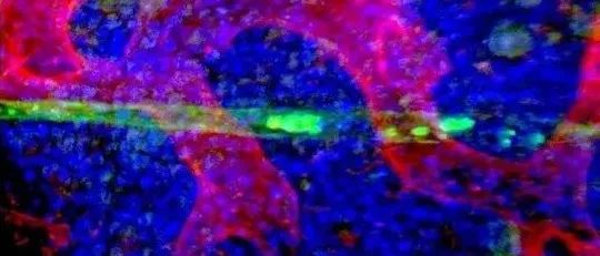Nature：一种微妙的平衡—肠道微生物“训练”免疫系统的新方法