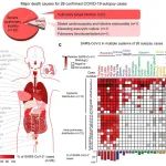 Cell Res：卞修武/平轶芳/张抒扬合作揭示新冠病毒引发的全身发病机制