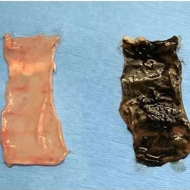 《科学》子刊：重大进展！开发出胃肠道合成上皮涂层，可用于递送药物、协助消化或阻止营养物吸收