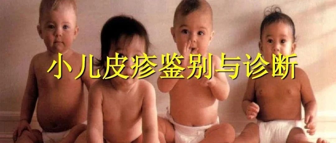 ｜凉血解毒颗粒｜关于小儿皮疹，辨别、预防与护理问题全奉上~