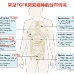 胆管癌丨FDA加速批准FGFR抑制剂『infigratinib』上市，F1CDx成伴随诊断！