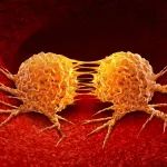 Science子刊：我国科学家领衔揭示生酮饮食有望成为癌症患者抗击低血小板的潜在拯救生命的疗法