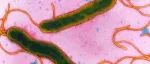 幽门螺旋杆菌列为明确致癌物，怎么检？