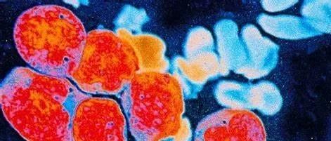 这一恶性肿瘤治疗获重大突破，提高30%生存率成为可能！
