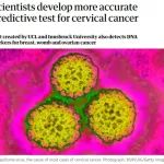 英国科学家开发新技术：通过检测DNA准确预测宫颈癌