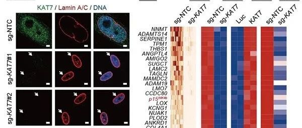 中国科学家Science子刊最新成果：抗衰老新靶点—— KAT7