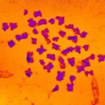 Science子刊：靶向调节性T细胞的免疫疗法