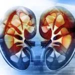 BioNews | Angion：公布ANG-3070一期临床阳性结果，二期临床在2021年启动