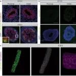 Nature新成果：打破限制，追踪致癌基因如何驱动癌细胞微环境重塑