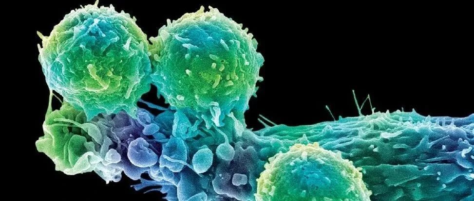 PD-L1抗体“新搭档”——HDAC8抑制剂 | Science子刊发表肝癌治疗突破