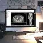 【创新大赛】后续报道之十九：医智影科技人工智能赋能放疗创新技术  获数千万元Pre-A轮投资