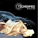 TechsoMed完成700万美元B轮融资，涌金资本参与