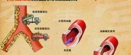 降胆固醇新药！阿斯利康与Dogma达成协议：获得全球首个口服小分子PCSK9抑制剂！