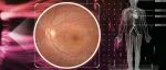 港股IPO | 鹰瞳Airdoc：视网膜影像人工智能识别的早期检测、辅助诊断及健康风险评估