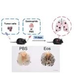 浙大沈华浩/应颂敏团队Science子刊揭示嗜酸性粒细胞促进肿瘤转移