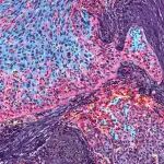 Ultivue完成5000万美元D轮融资