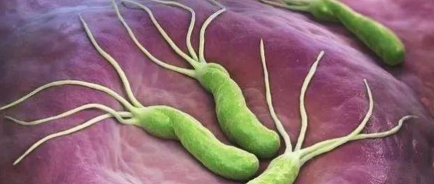 真相：幽门螺杆菌一定能致癌？这份关于幽门螺杆菌的最全科普请查收！