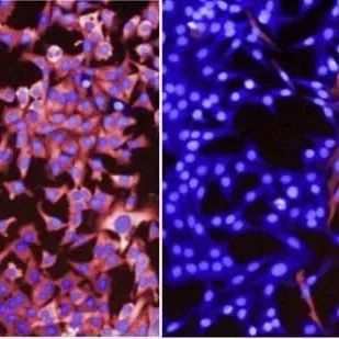 Cell子刊解读！科学家们揭示黑色素瘤细胞躲避靶向性疗法得以生存的新型分子机制！