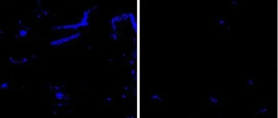 Science子刊：揭示APOE免疫疗法可减少脑淀粉样血管病和淀粉样蛋白斑块，同时改善脑血管功能