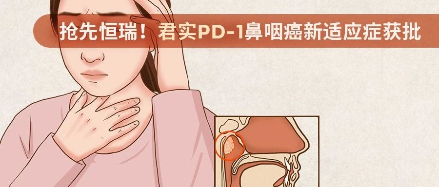 抢先恒瑞！君实PD-1鼻咽癌新适应症获批