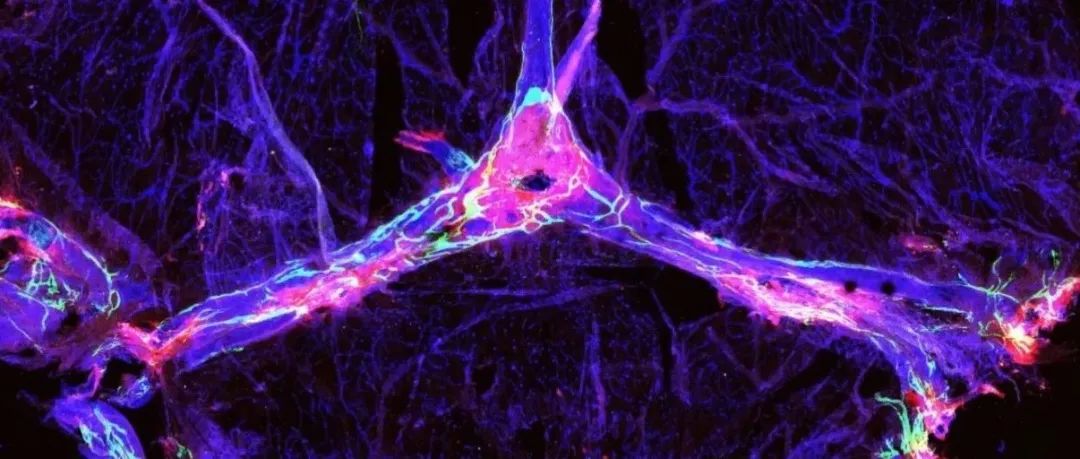 Aβ抗体开发迎来转机？Nature揭示改善阿尔茨海默症治疗关键途径