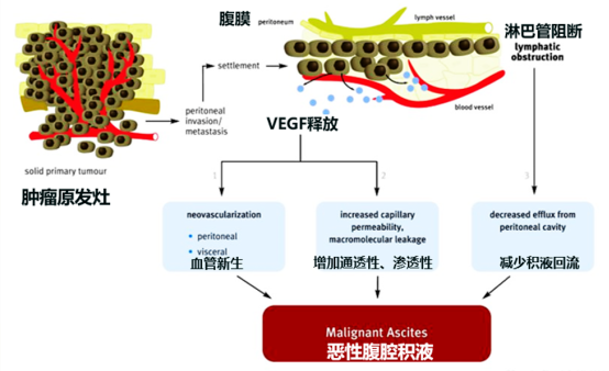 先声药业恩度03联合顺铂治疗胸腹腔积液iii期临床试验申请获cde批准