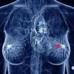 Nature：单细胞测序揭示乳腺癌和卵巢癌的突变过程