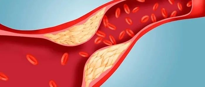 意外发现！Science：“好胆固醇”竟然还能隐藏炎症分子，保护肝脏！