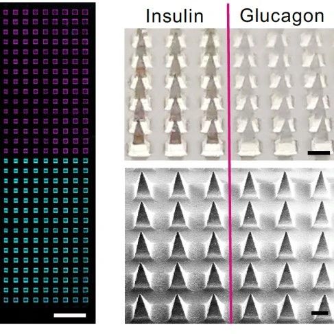 浙江大学顾臻教授团队《PNAS》：研制血糖响应智能胰岛素/胰高血糖素复合贴片