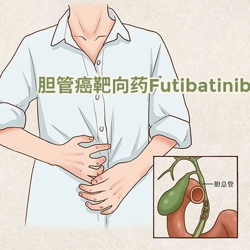 研发 | 新药频出，胆管癌靶向药Futibatinib控制率超80%，前景光明