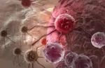 如何更有效地治疗非小细胞肺癌？麻省理工学院的科学家发现一种方法能为患者带来希望！