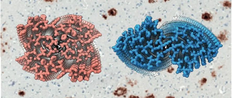 Science | 阿尔兹海默病相关蛋白Aβ42纤维结构被揭示